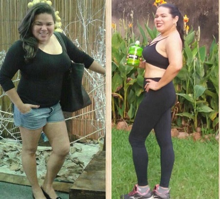 Left or right antes e depois sirley jordao